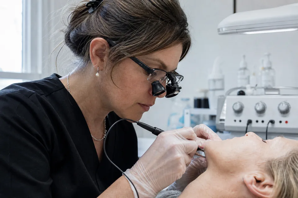 An electrologist working with a fine probe under a magnifying lamp on a client's upper lip area